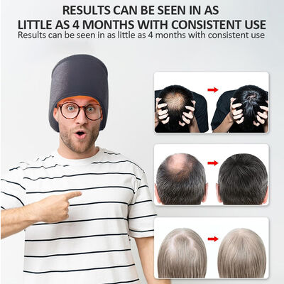 660nm Hair Growth Cap Led Red Light Therapy And 270 Led Red Light And Laser Therapy Cap